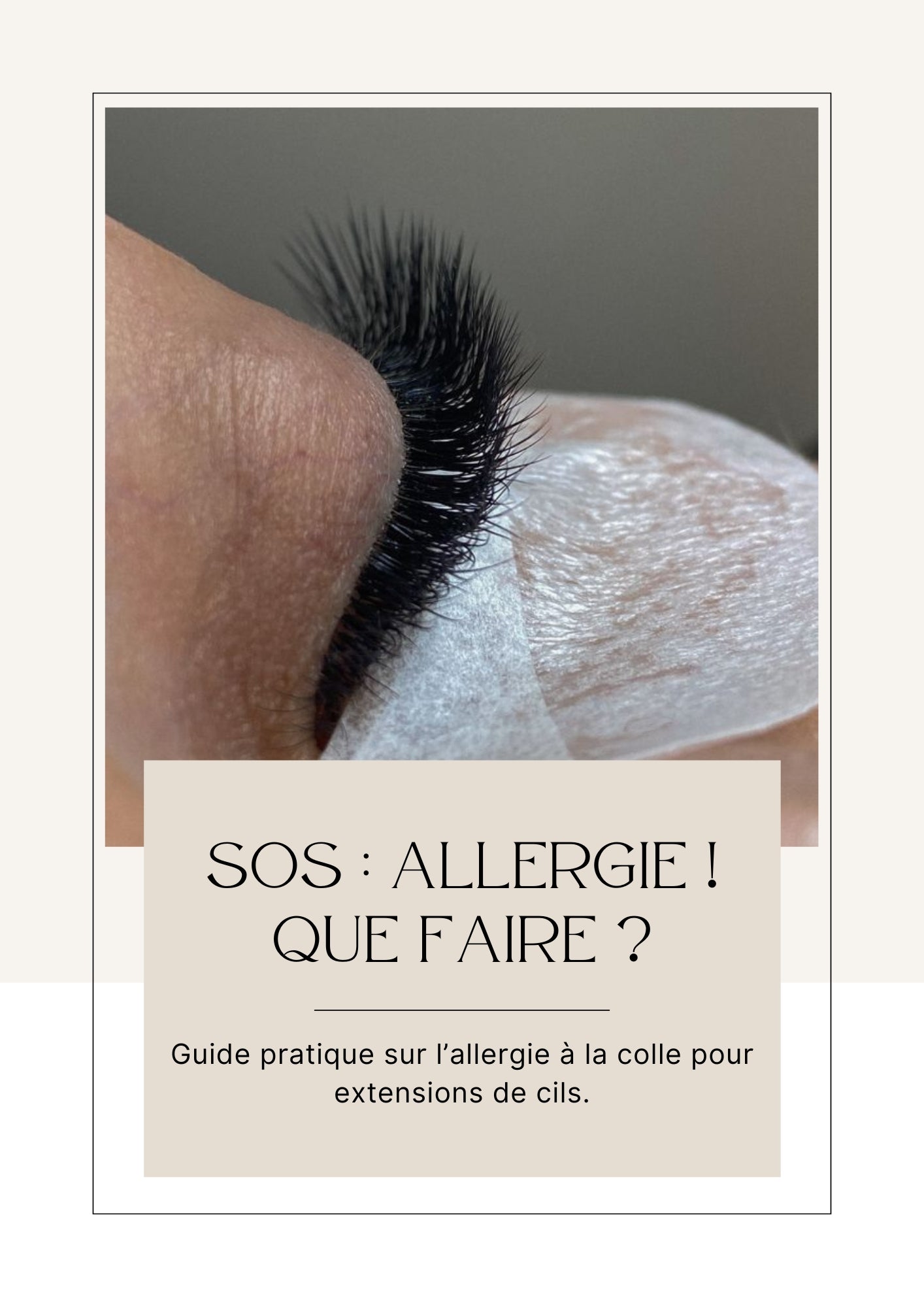 SOS ALLERGIE : Que faire ?